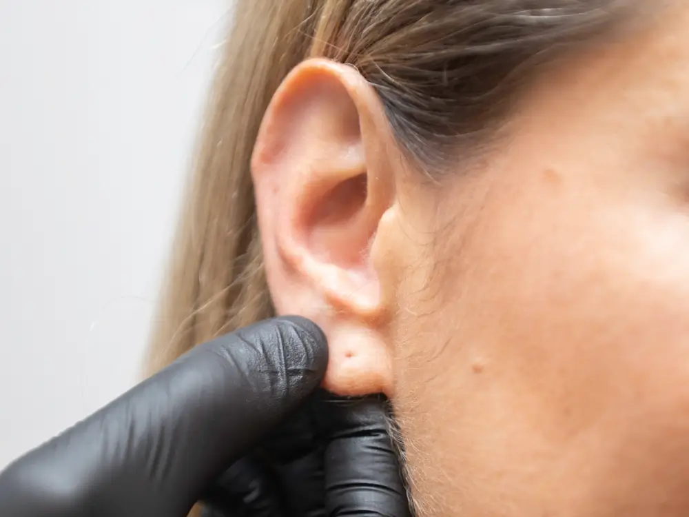 chirurgie-oreilles-decollees-dr-colson