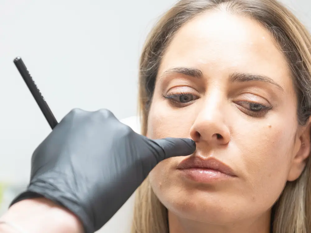 rhinoplastie-dr-colson