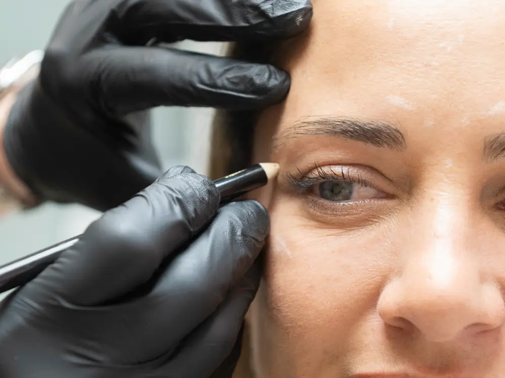 chirurgie-capillaire-greffe-sourcils