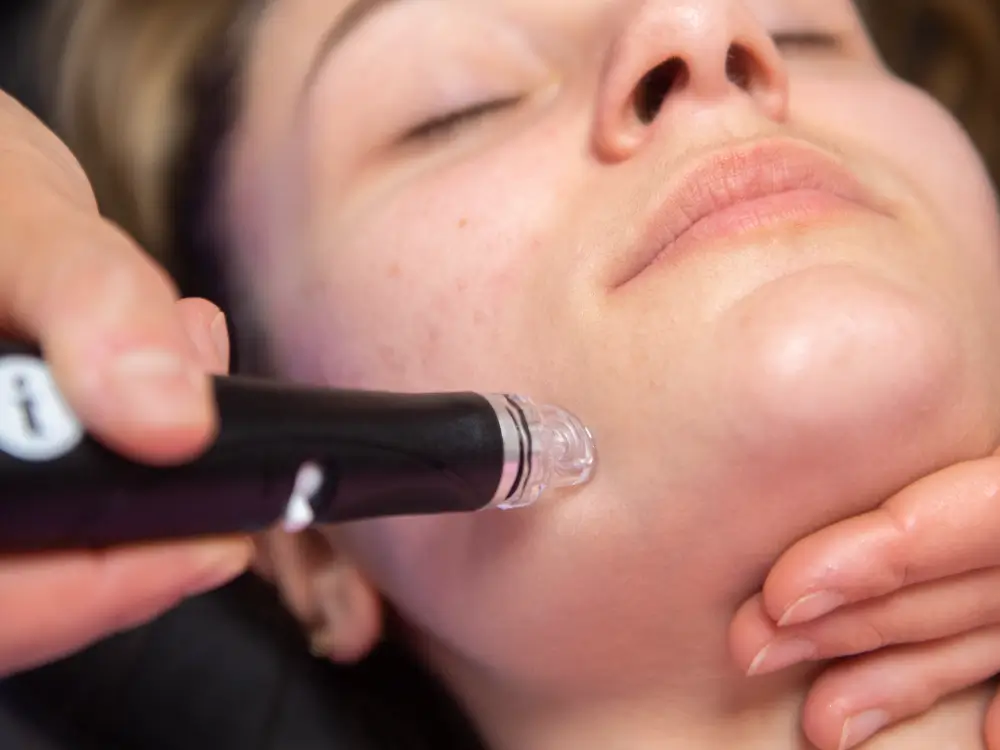 medecine-ethetique-hydrafacial